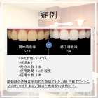 北九州で唯一【医療提携】歯科監修セルフホワイトニング
